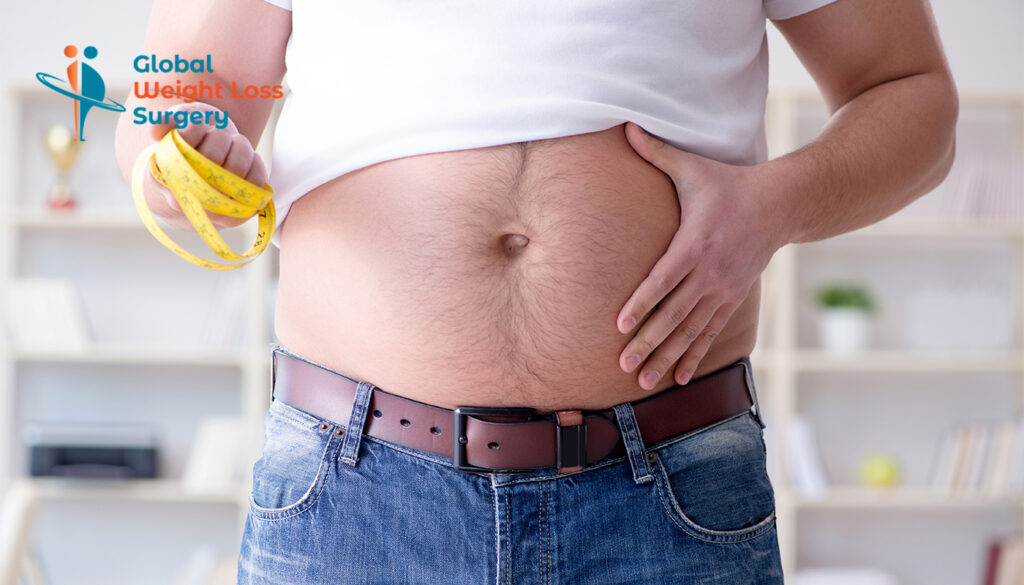 How to Prepare for Gastric Sleeve Surgery in Mexico