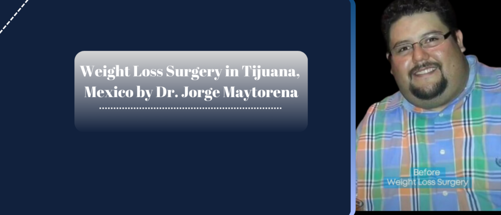Weight Loss Surgery in Tijuana, Mexico by Dr. Jorge Maytorena